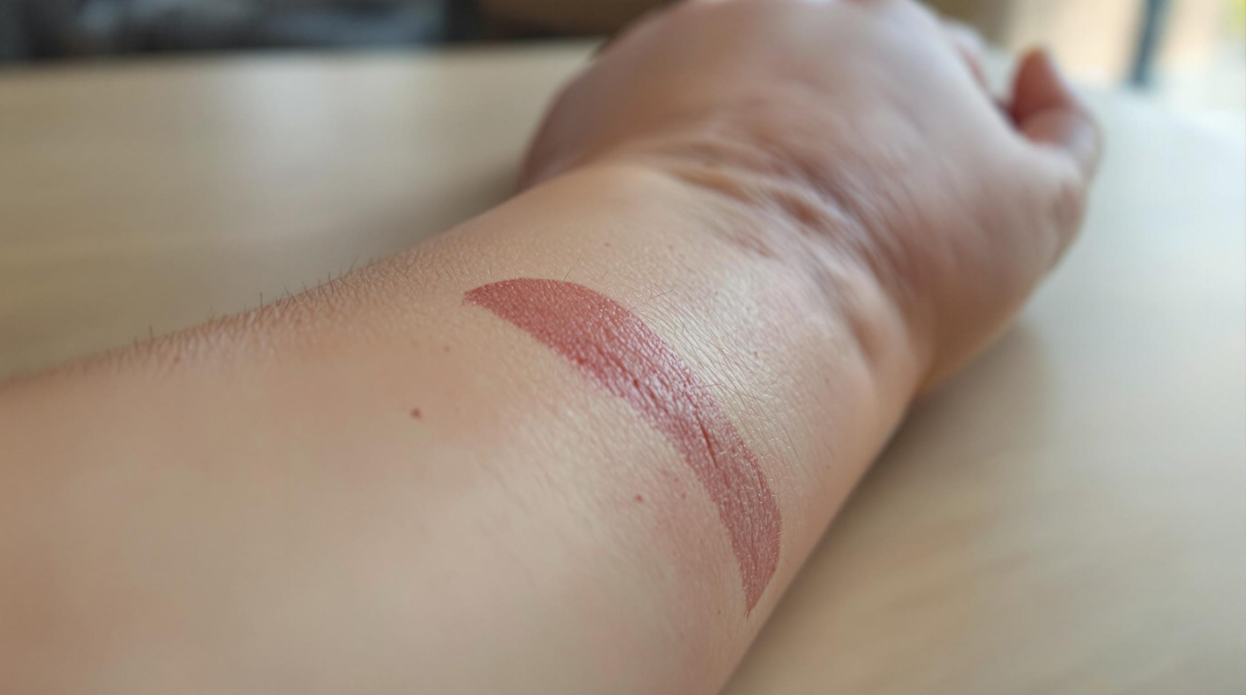 Comprendre et traiter les cicatrices douloureuses - Reine Cosmetique